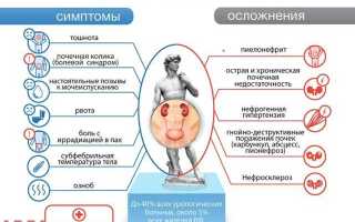 Урологические препараты при мочекаменной