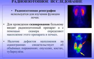Почки урология или нет
